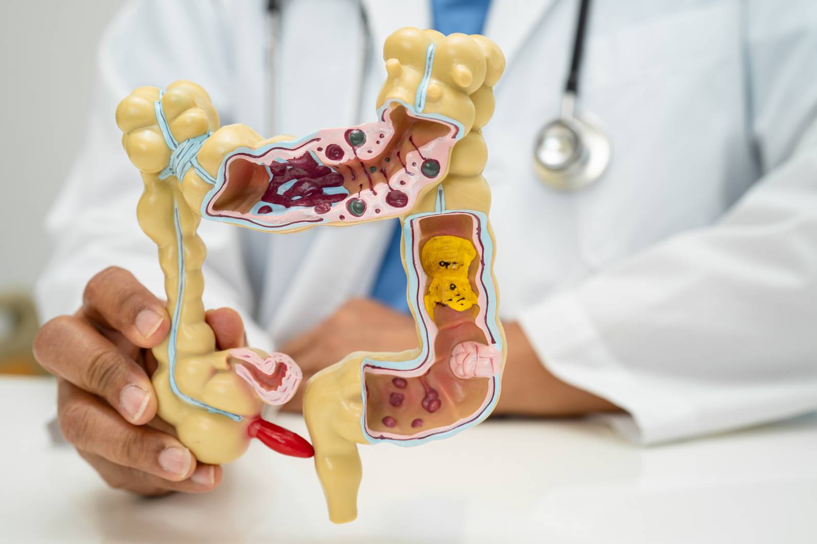 🌡️ Gastrointestinal & Hemorrhoid Care